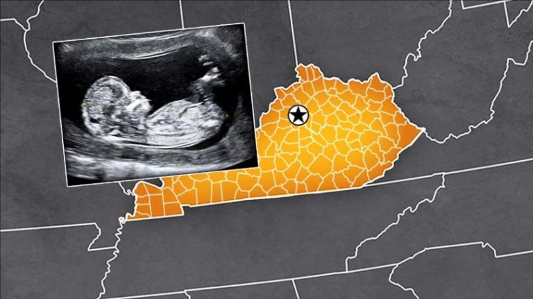 USA: Stan Kentucky wprowadza obostrzenia dotyczące aborcji