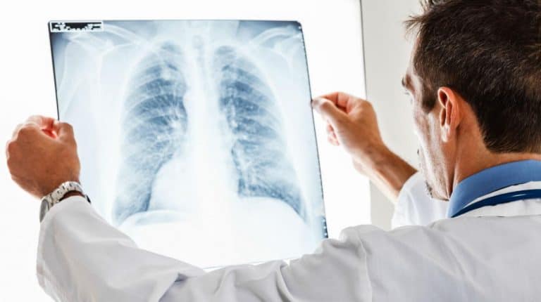 Ekspert: choroby płuc coraz częstsze, wiele z nich związanych z alergiami