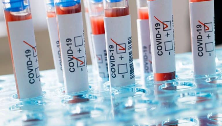 Agencja Rozwoju Przemysłu zakupiła 300 tysięcy testów na koronawirusa