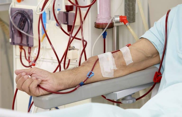 COVID-19 szczególnie groźny dla dializowanych pacjentów