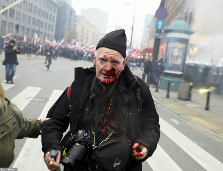 Postrzelony fotoreporter Tygodnika Solidarność: Wydaje mi się, że policja dostała takie dyrektywy