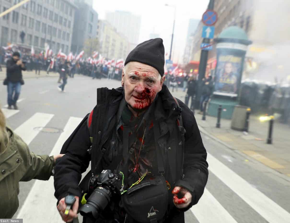 Postrzelony fotoreporter Tygodnika Solidarność: Wydaje mi się, że policja dostała takie dyrektywy