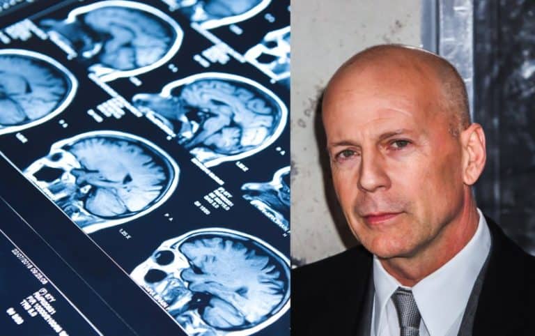 Bruce Willis zakończył swa karierę aktorską z powodu choroby