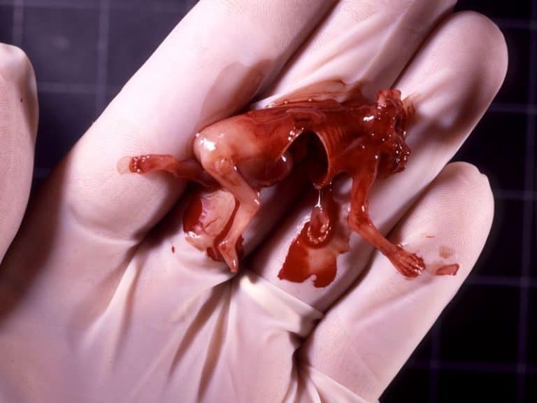 Skrajna lewica ufundowała szpitalowi maszyny aborcyjne
