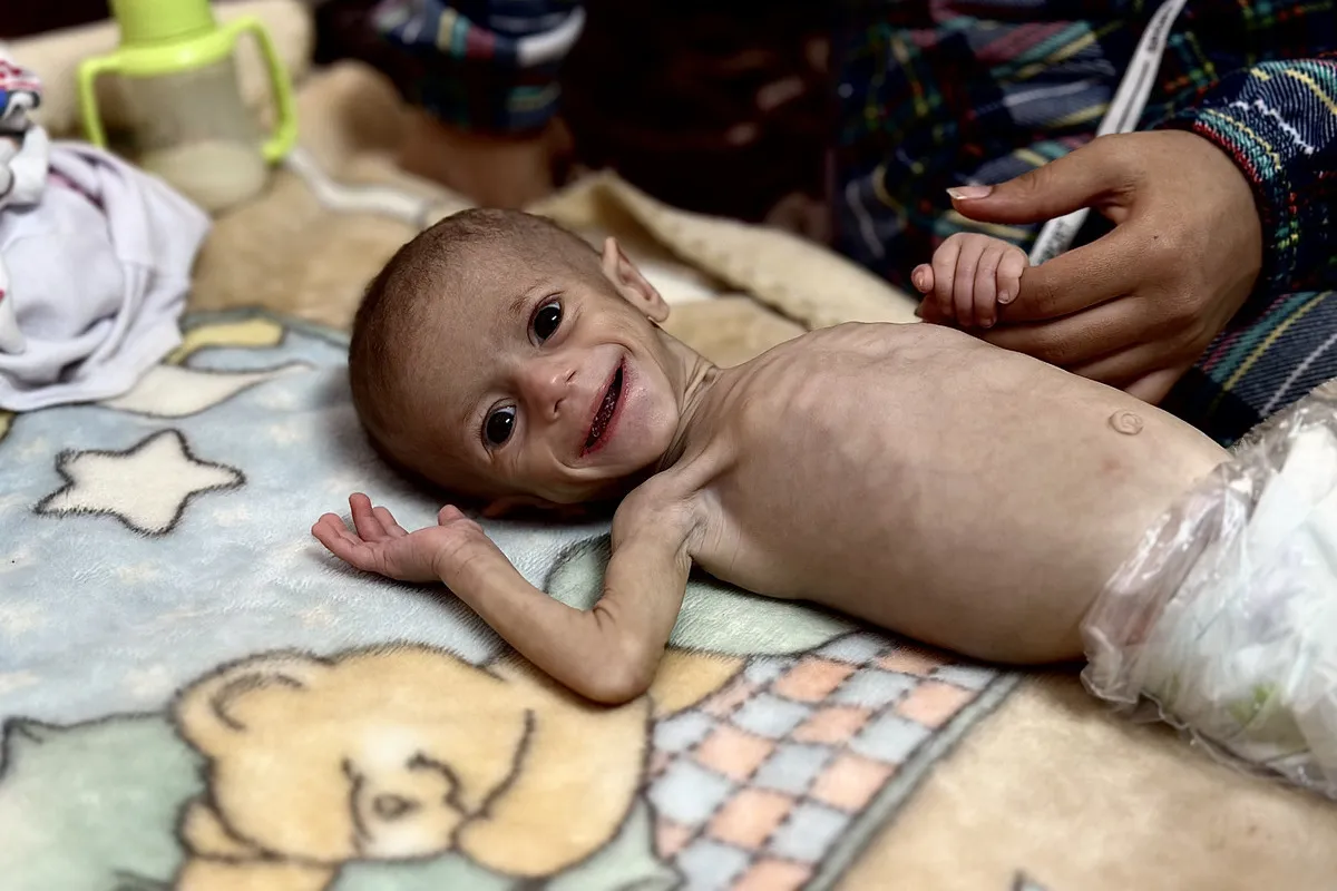 57 osób zmarło z głodu w Strefie Gazy